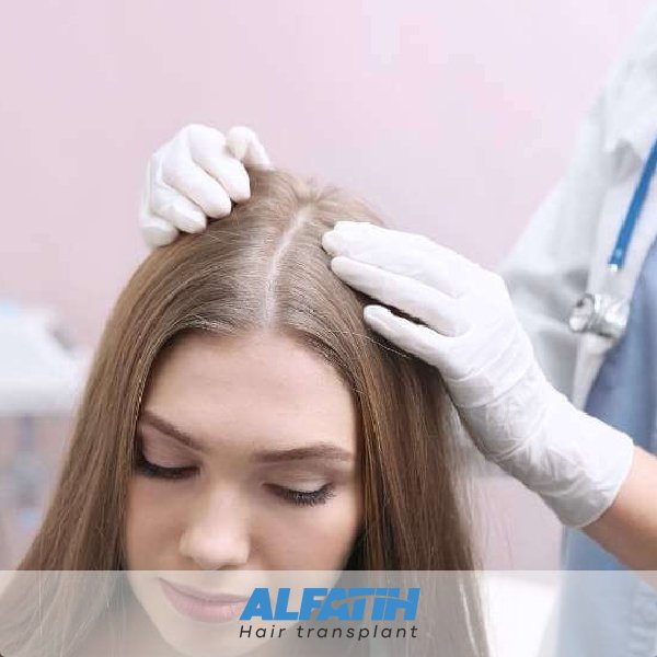 How is hair transplantation done for women