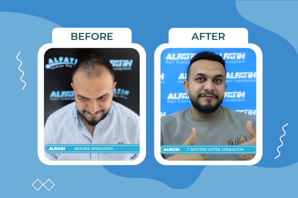 Al-Fateh clients before and after transplantation 2