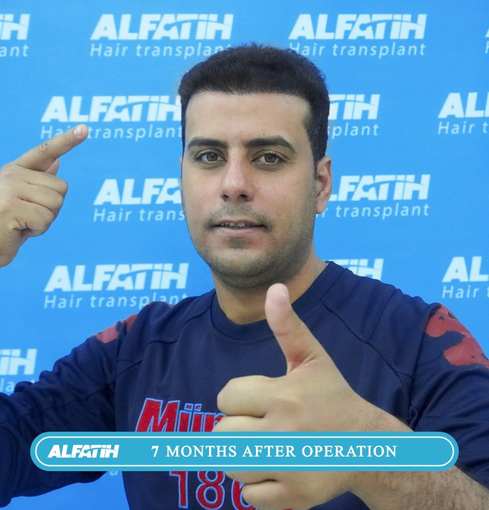 Al-Fateh clients before and after transplantation 