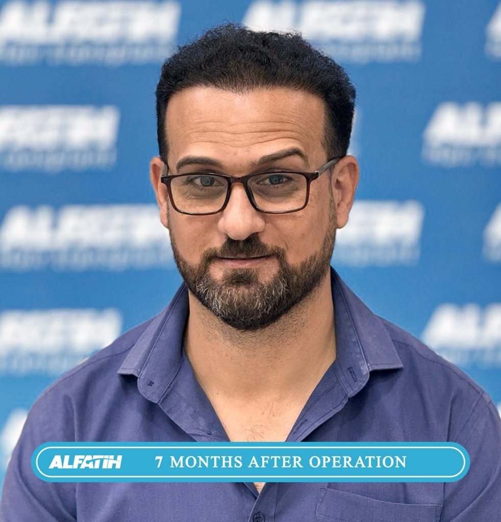 Al-Fateh clients before and after transplantation 