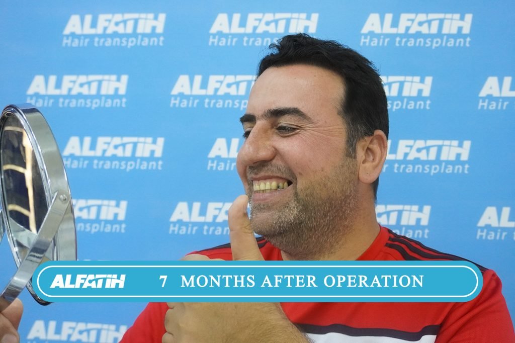 Al-Fateh clients before and after transplantation 