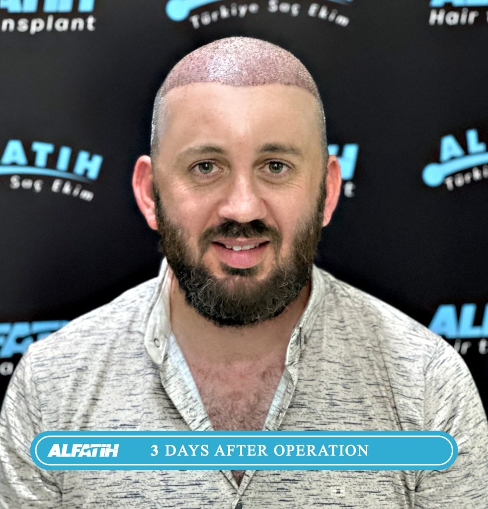 Al-Fateh clients before and after transplantation 